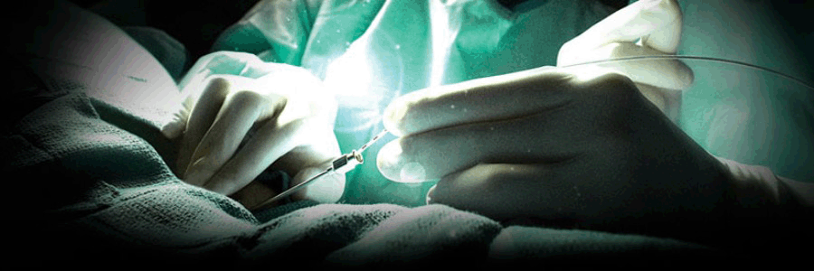 השתלת אלקטרודות לגירוי עמוד השדרה